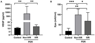 Reduced Expression of Erythropoietin After Intravitreal Ranibizumab in Proliferative Diabetic Retinopathy Patients—Retrospective Interventional Study